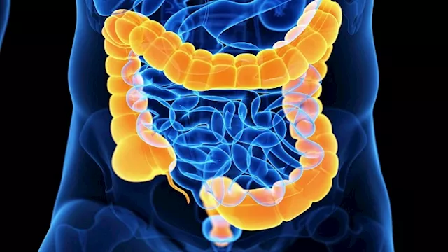 القواون العصبي