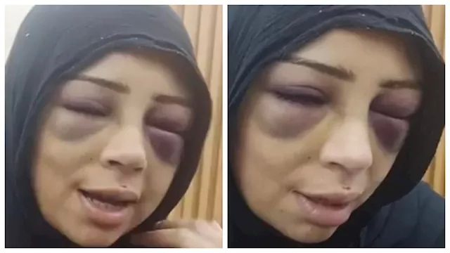 فتاة بورسعيد تكشف تفاصيل اعتداء خطيبها السابق عليه