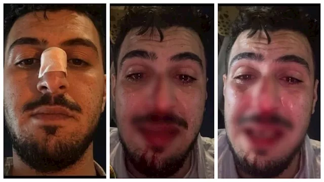 تفاصيل جديدة في واقعة التعدي على صاحب فيديو زفة ده