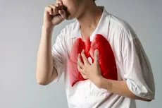 متى يكون مرض السل غير معدي؟- إليك طرق الوقاية من مخاطره 