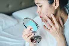 أعراض نقص الفيتامينات- 6 علامات تظهر على الوجه احذرها  
