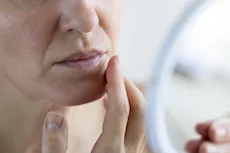 شكل نقص فيتامين B12 على الوجه- 7 أعراض تظهر عليه احذرها