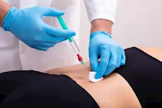 دراسة دولية تشكك في فاعلية الحقن الموضعي لعلاج آلام الظهر.. طبيب يوضح 