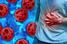 مرض في أمريكا- ما هو الطفيلي المعوي المنتشر بالولايات المتحدة؟