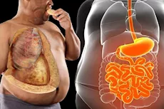  علاج الدهون الحشوية- تناول هذه الأطعمة للتخلص منها    