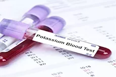 ما هي الأدوية التي تسبب انخفاض مستوى البوتاسيوم؟- طبيب يوضح