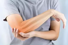 كيف أعرف نقص المغنيسيوم بدون تحليل؟- طبيب يوضح         
