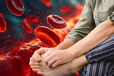 أعراض ارتفاع الضغط عند الرجال- 5 علامات تظهر على القدمين
