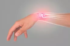 تقنية جراحية جديدة تساعد مرضى كسور الرسغ على التعافي أسرع