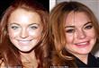 نجمات تغيرت حياتهم بعد عمليات التجميل                                                                                                                 