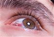 ئح بسيطة لوقاية العين من الأمراض