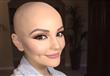 فتاة تتحدى السرطان بجلسة تصوير مبهرة                                                                                                                                                                    