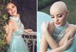 فتاة تتحدى السرطان بجلسة تصوير مبهرة                                                                                                                                                                    