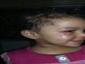 طفلة الحضانة (2)                                                                                                                                                                                        