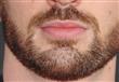  5 وصفات طبيعية لتكثيف اللحية