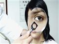 إصابات العين تسبب مضاعفات خطيرة.. هكذا تحمي نفسك