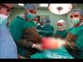 جراحة نادرة بمستشفى التأمين الصحي ببني سويف