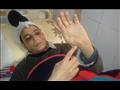 الموظف المجني عليه يلوح بالإصابات بيده عندما حاول التصدي للضربات