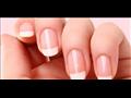  لماذا تظهر بقع بيضاء على الأظافر؟ 