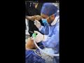 جراحة نادرة في جامعة بنها (2)