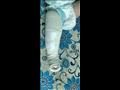 جبيرة في قدم الطفلة