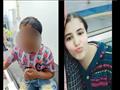الطفلة أمنية ما قبل وبعد الحروق بسبب التعذيب