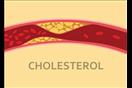 ارتفاع الكوليسترول