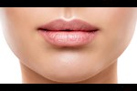أسباب ظهور الحبوب البيضاء على الشفاه.. إليك طرق العلاج 
