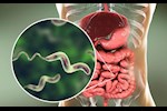 جرثومة المعدة لا تستجيب للعلاج.. 5 أخطاء قد تقلل فرص الشفاء