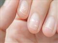 الأظافر البيضاء