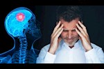 تأثير نقص الفيتامين د على الأعصاب