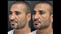 أحمد سعد قبل وبعد التجميل