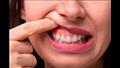 علاج مشاكل اللثة