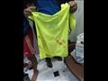 دماء على قميص رياضي