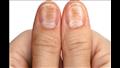إذا لاحظت هذا على أظافرك يشير إلى مرض خطير