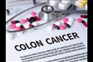 سرطان القولون