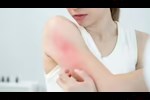 هل تكشف بشرتك عن صحتك العقلية؟.. دراسة تكشف مفاجأة 