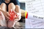 وداعًا لارتفاع حمض اليوريك- 5 فواكه تساعد على خفضه