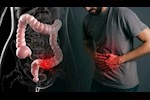 هل خمول الغدة الدرقية يسبب الإمساك؟.. طبيب يوضح