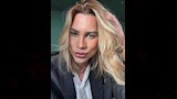بعد وفاة مؤثر الموضة البرازيلي.. تعرف على جراحة "عيون الثعلب" ومخاطرها
