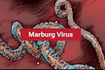 ليس له علاج- ماذا نعرف عن فيروس ماربورج المنتشر في أثيوبيا؟