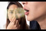 التهاب اللوزتين.. هل يتسبب في رائحة الفم الكريهة؟