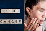 انتبه لبشرتك- 4 أعراض لسرطان القولون قد تظهر عليها