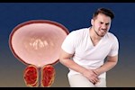 هل احتقان البروستاتا يمكن أن تتسبب في الالتهابات؟.. طبيب