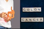 سرطان القولون في المرحلة الأخيرة- إليك أعراضه