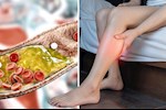 انتبه لساقيك- 6 أعراض ليلية لارتفاع الكوليسترول تظهر عليهما