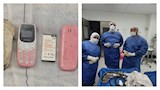 ‬استخراج موبايل من معدة مريض في عملية نادرة بالقلي