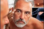 انتبه لوجهك- 10 علامات لارتفاع دهون الكبد تظهر عليه