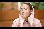 كيف يؤثر البهاق على الصحة العقلية؟ 