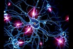 احذر- 5 أعراض تكشف إصابتك بتلف الأعصاب